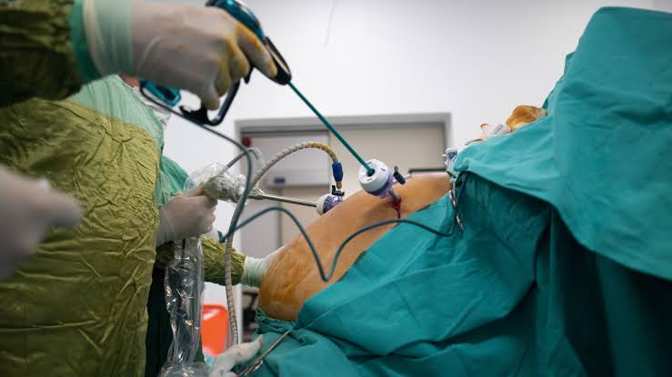 Bariatric Surgery in India