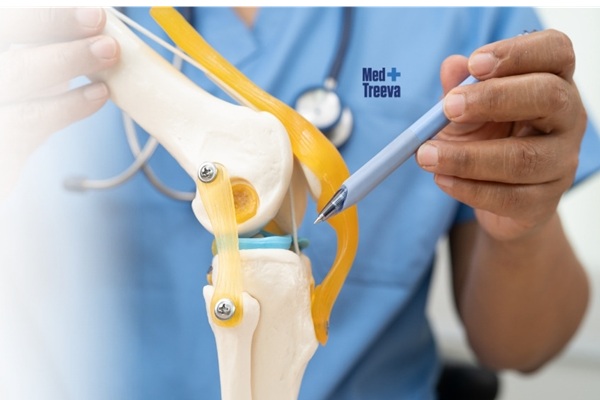 Knee Replacement Surgery in India